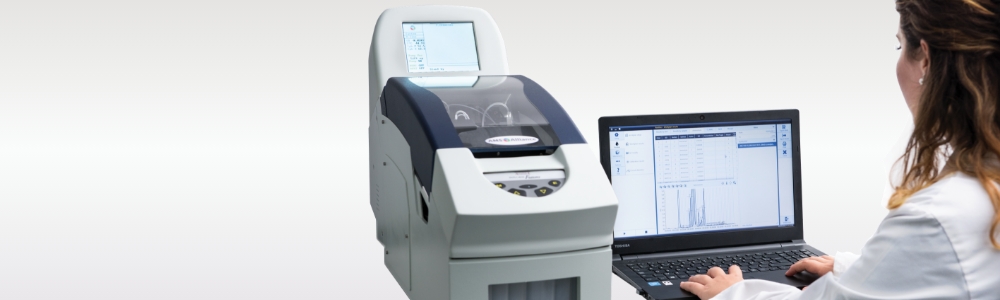 Thin layer chromatography